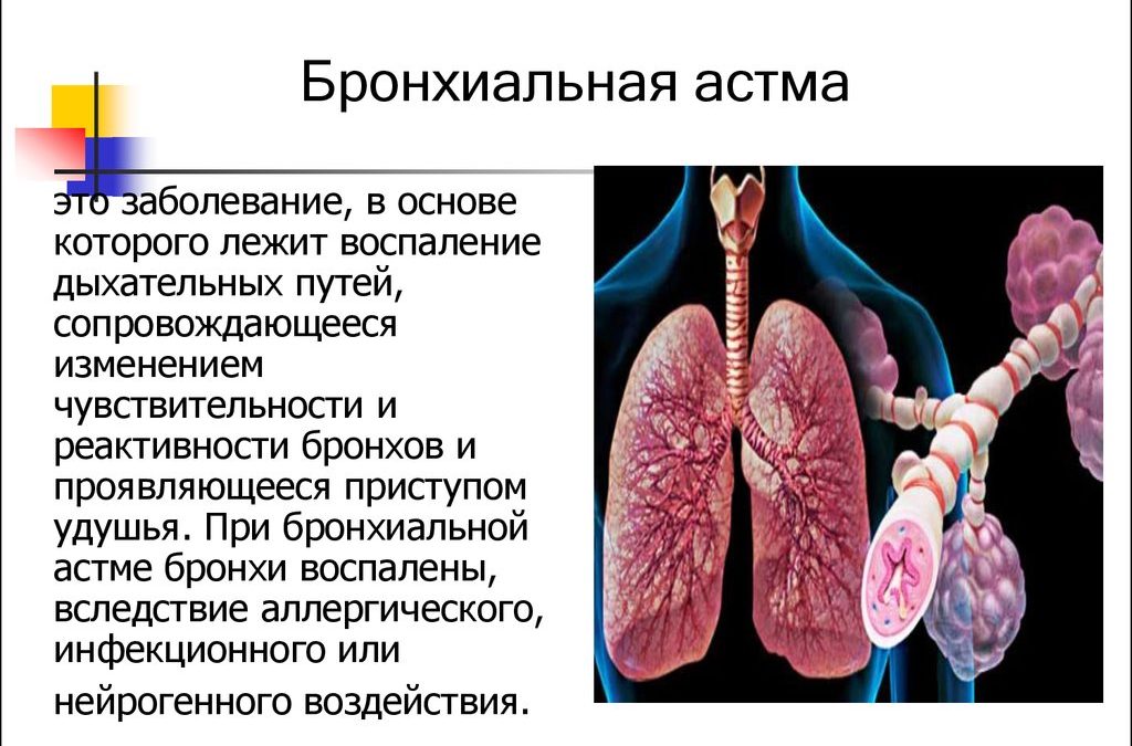 Лечение бронхиальной астмы. Терапия.(1)